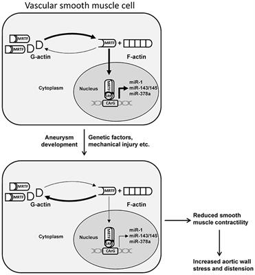 Molecular Regulation of Arterial Aneurysms: Role of Actin Dynamics and microRNAs in Vascular Smooth Muscle